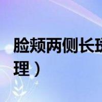 脸颊两侧长斑怎么调理（脸颊两侧长斑怎么调理）