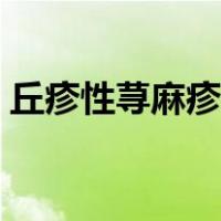 丘疹性荨麻疹偏方知乎（丘疹性荨麻疹偏方）