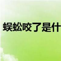 蜈蚣咬了是什么症状图片（蜈蚣咬了怎么办）