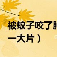 被蚊子咬了肿了一大片很疼（被蚊子咬了肿了一大片）