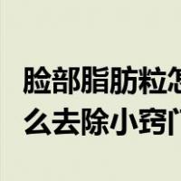 脸部脂肪粒怎么去除小窍门（脸上的脂肪粒怎么去除小窍门）
