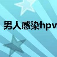 男人感染hpv什么症状（男人同性恋的症状）