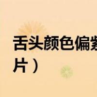 舌头颜色偏紫色是怎么回事（舌头颜色发紫图片）