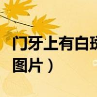 门牙上有白斑图片能做洁牙吗（门牙上有白斑图片）