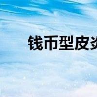 钱币型皮炎图片大全（皮炎图片大全）