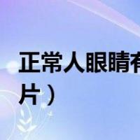 正常人眼睛有红血丝吗（正常人眼睛红血丝图片）