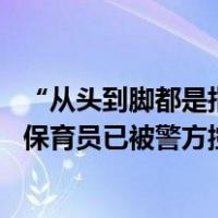 “从头到脚都是指甲印！”家长称3岁男童在幼儿园被虐待，保育员已被警方控制 这是什么情况？
