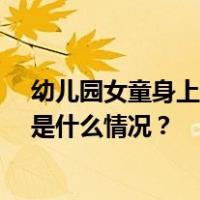 幼儿园女童身上出现12个针眼，呼和浩特警方介入调查 这是什么情况？