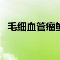 毛细血管瘤鲜红斑痣图片（鲜红斑痣图片）